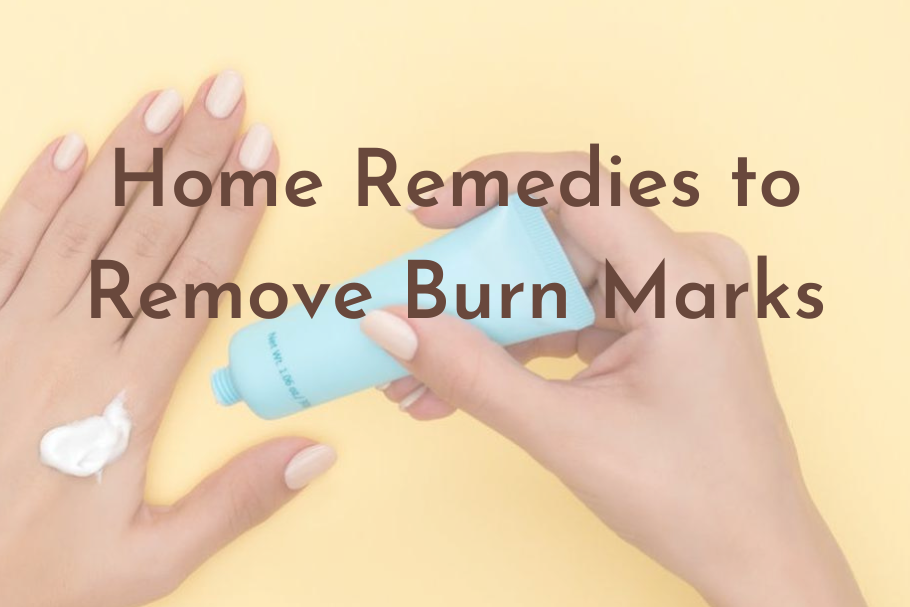 How To Remove Burn Marks Here Are 9 Best Home Remedies To Try