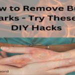 how-to-remove-burn-marks