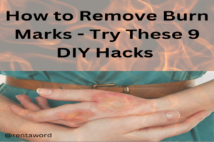 Your Expert Guide on How to Remove Burn Marks - Try These 9 DIY Hacks